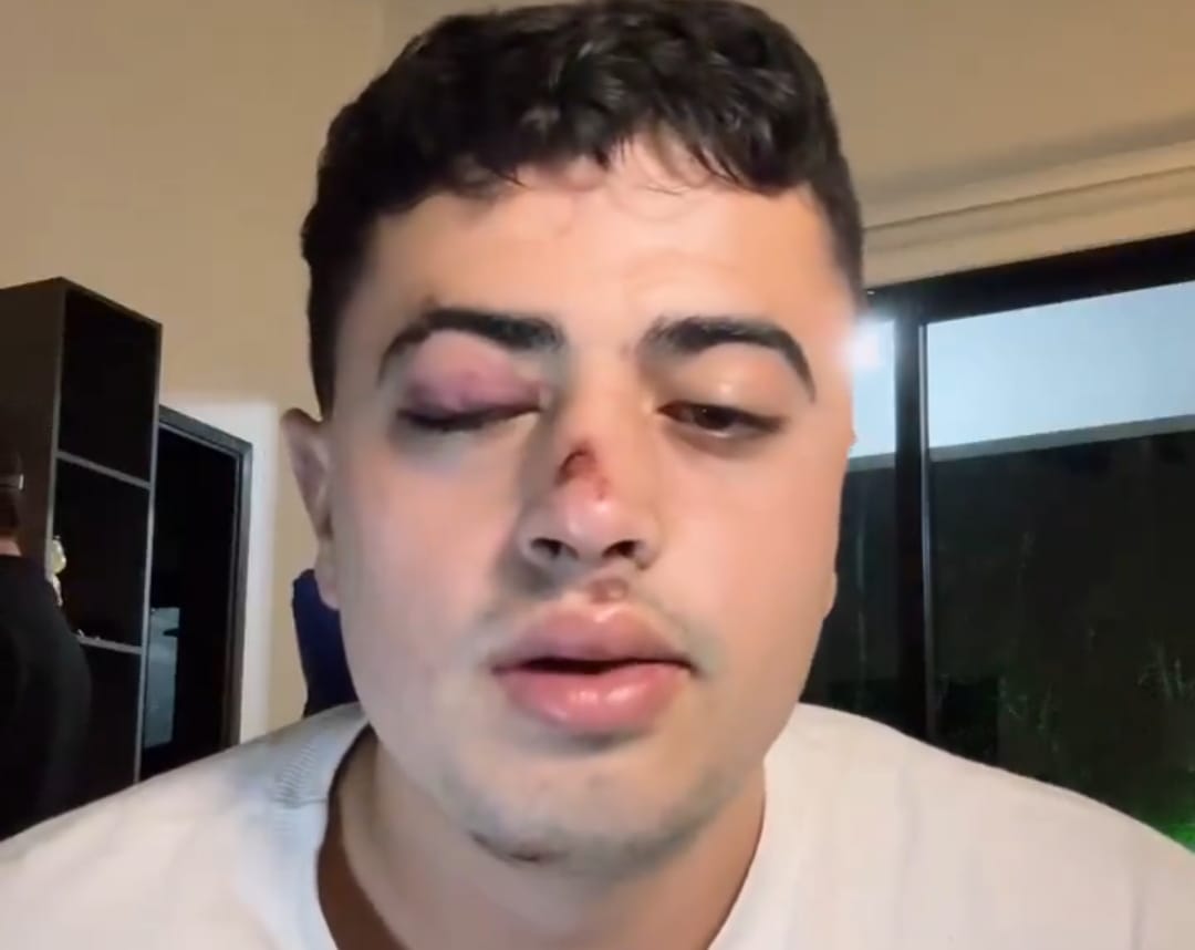 Joven denunció que fue drogado y robado en Medellín