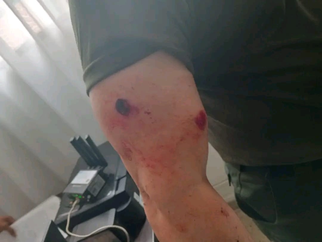 Coronel herido en Cañasgordas Antioquia