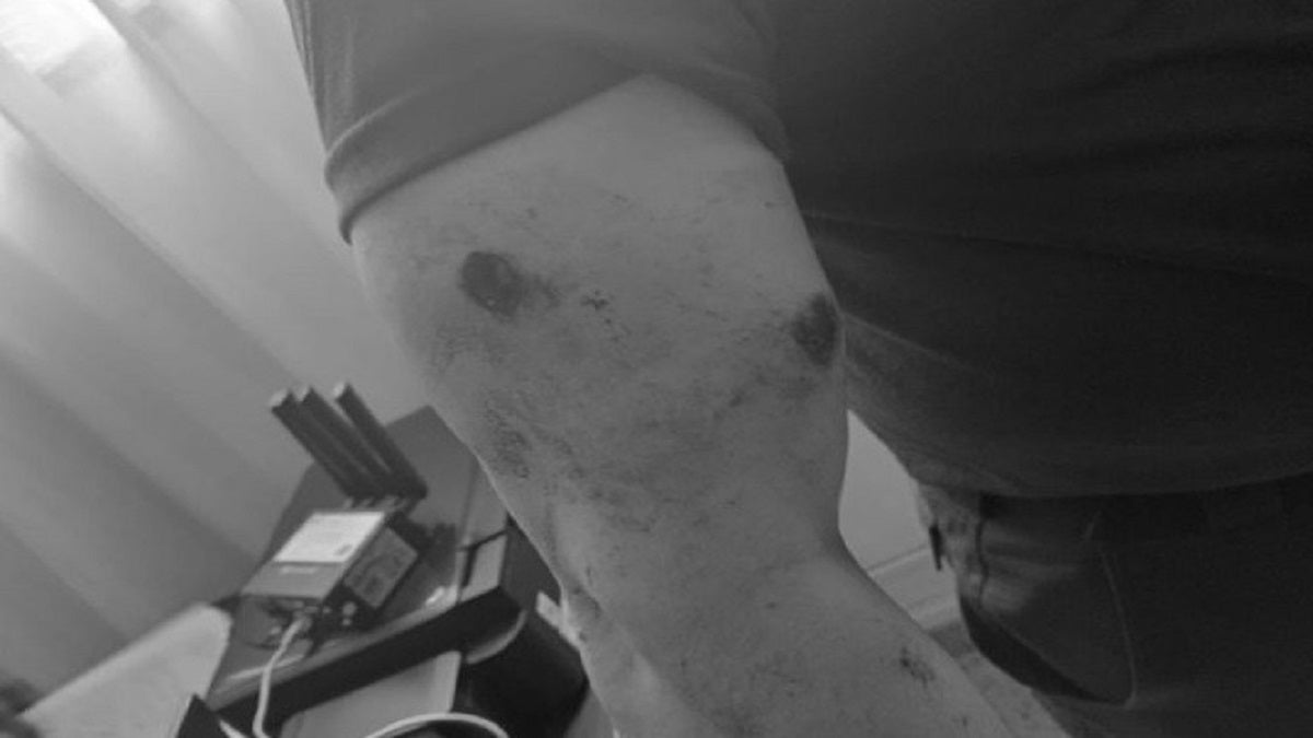 Herido comandante operativo de Policía Antioquia