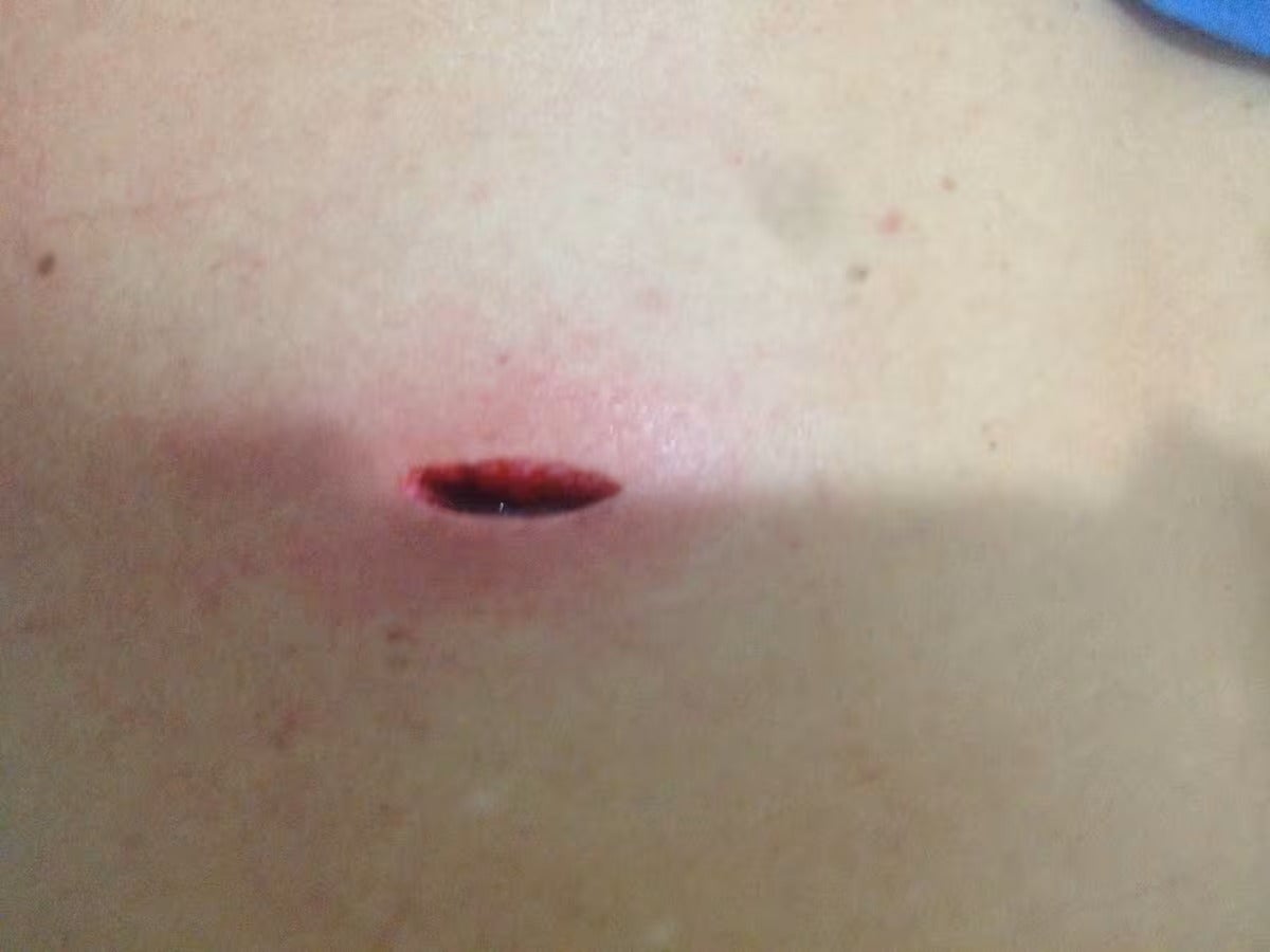 La apuñalaron tres veces durante la rumba, salió al hospital y murió en su casa en Bello