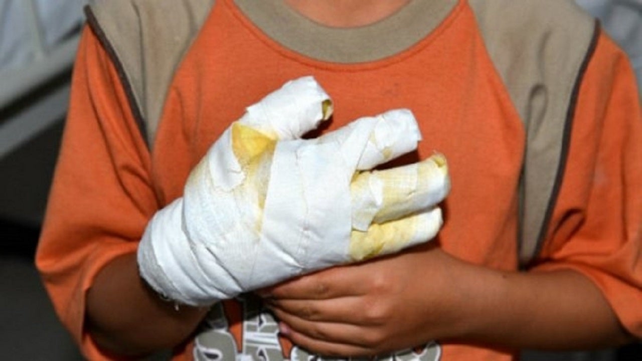 Las autoridades regionales confirmaron ocho nuevos casos registrados en las últimas 48 horas.