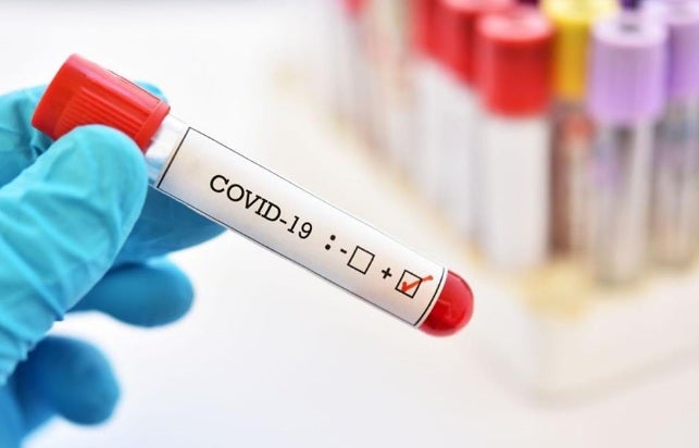 Tres alcaldes en Santander dieron positivo para la Covid-19