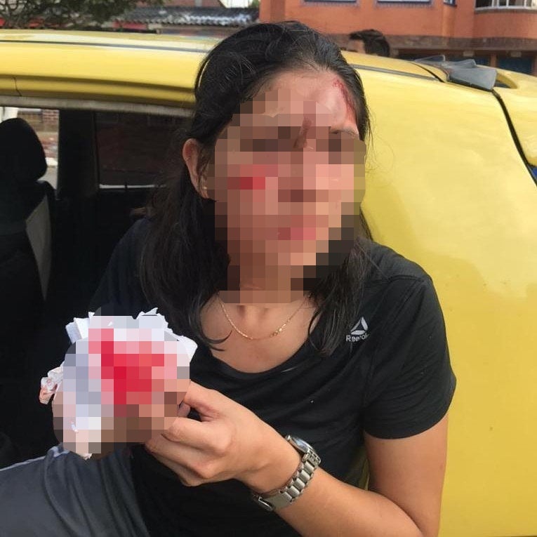 Mujer quien recibió un botellazo en su rostro