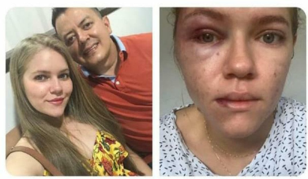 Johana Espejo señala al concejal Deiby Arias de haberla agredido