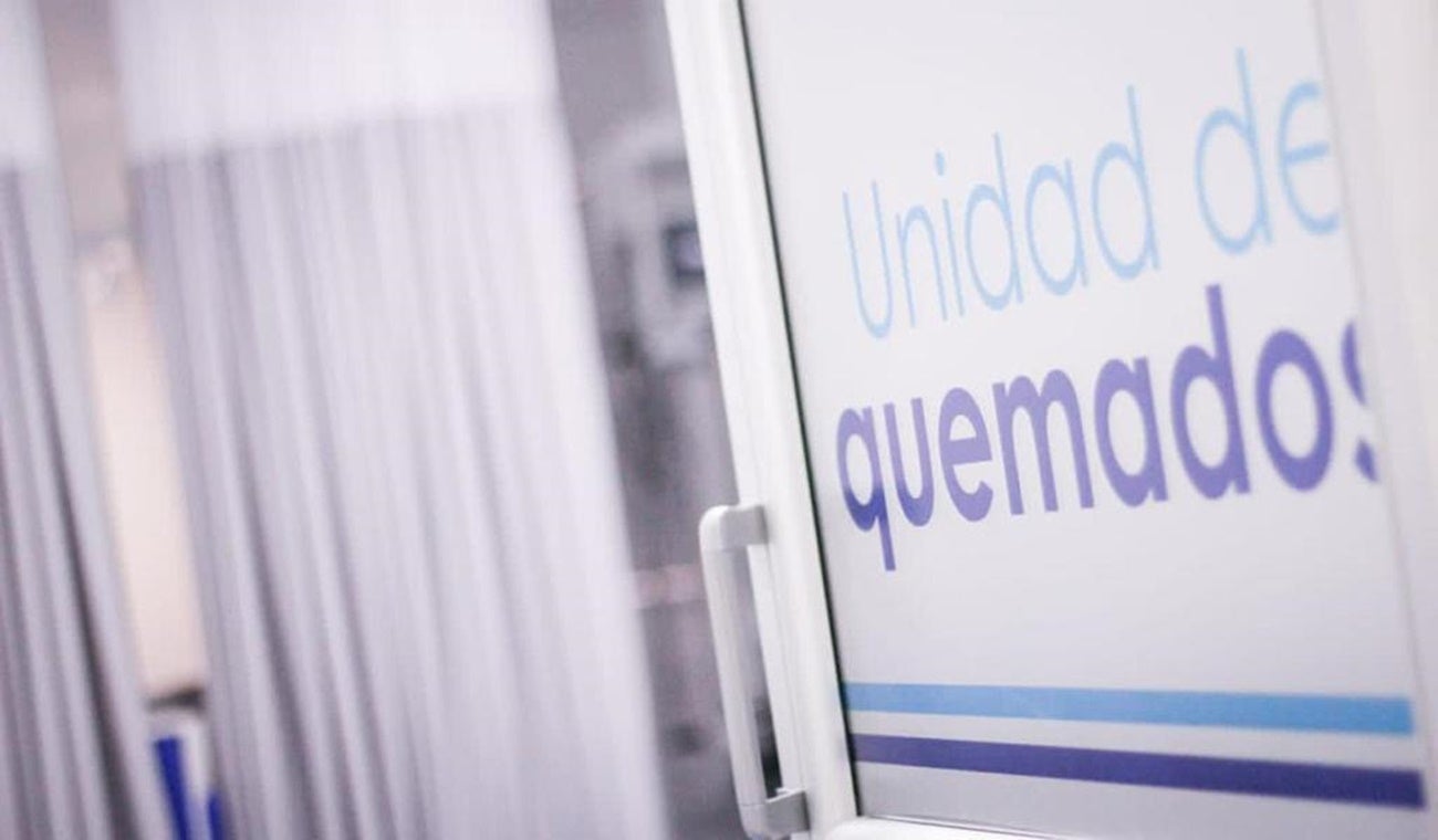 Unidad quemados hospital Federico