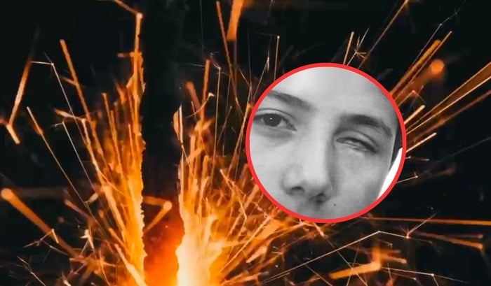 Alcalde de Bucaramanga Jaime Andrés Beltrán perdió su ojo izquierdo a los 7 años