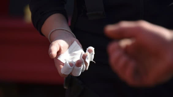 La cifra de quemados en Santander estaba en cero.