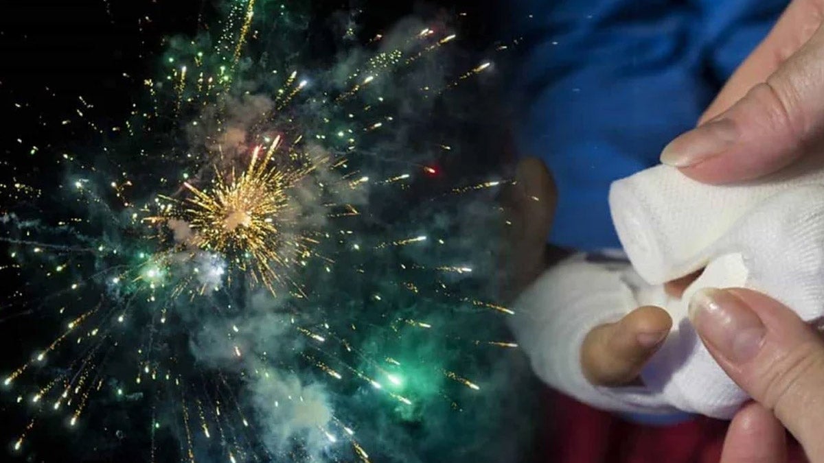 Dos personas resultaron quemadas con pólvora en Floridablanca.