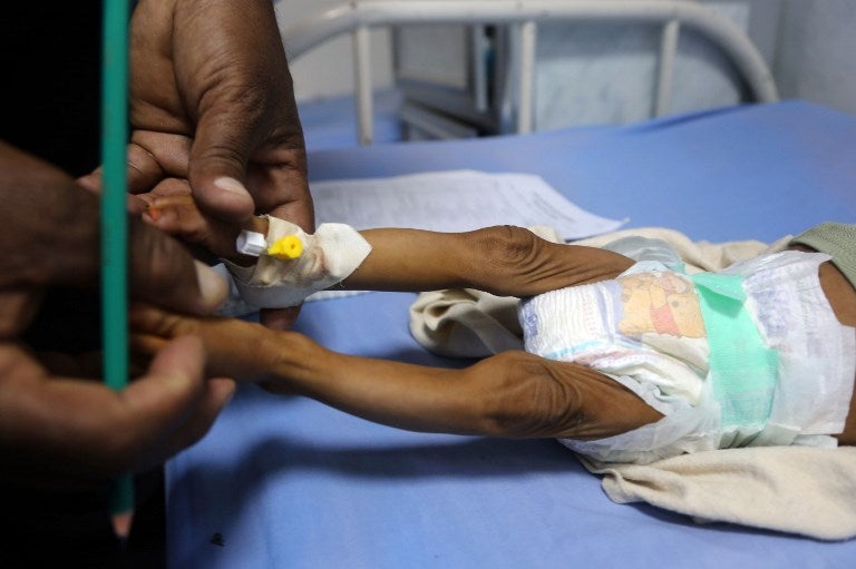 Desnutrición infantil