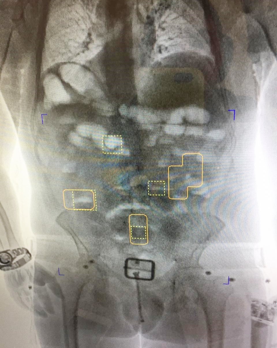 La persona detenida, tenía como destino viajar con esta cantidad de droga hacia Madrid, España.