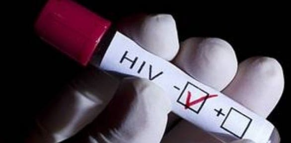 La actividad está asociada a la ruleta rusa sexual, práctica que consiste en tener relaciones sexuales aplicándose sustancias antirretrovirales