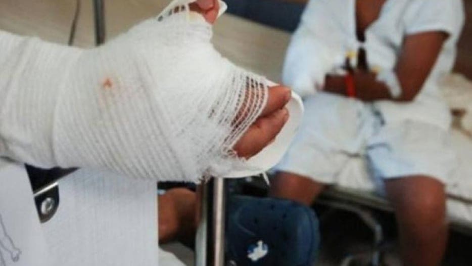 El municipio que más casos ha notificado en esta temporada ha sido Ibagué con 23 casos; de los cuales 4 casos fueron en menores de edad