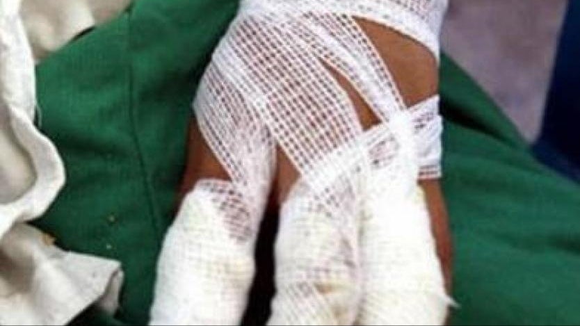 Quemados con Pólvora