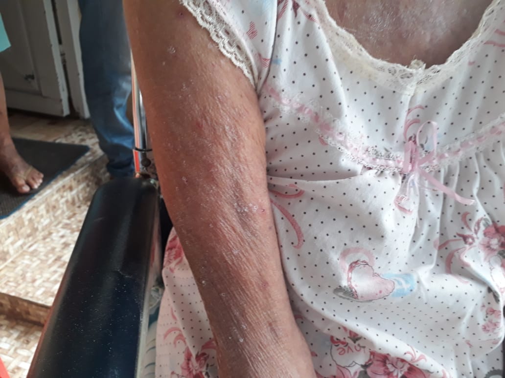 Fuga de agua y malos olores en el Topacio