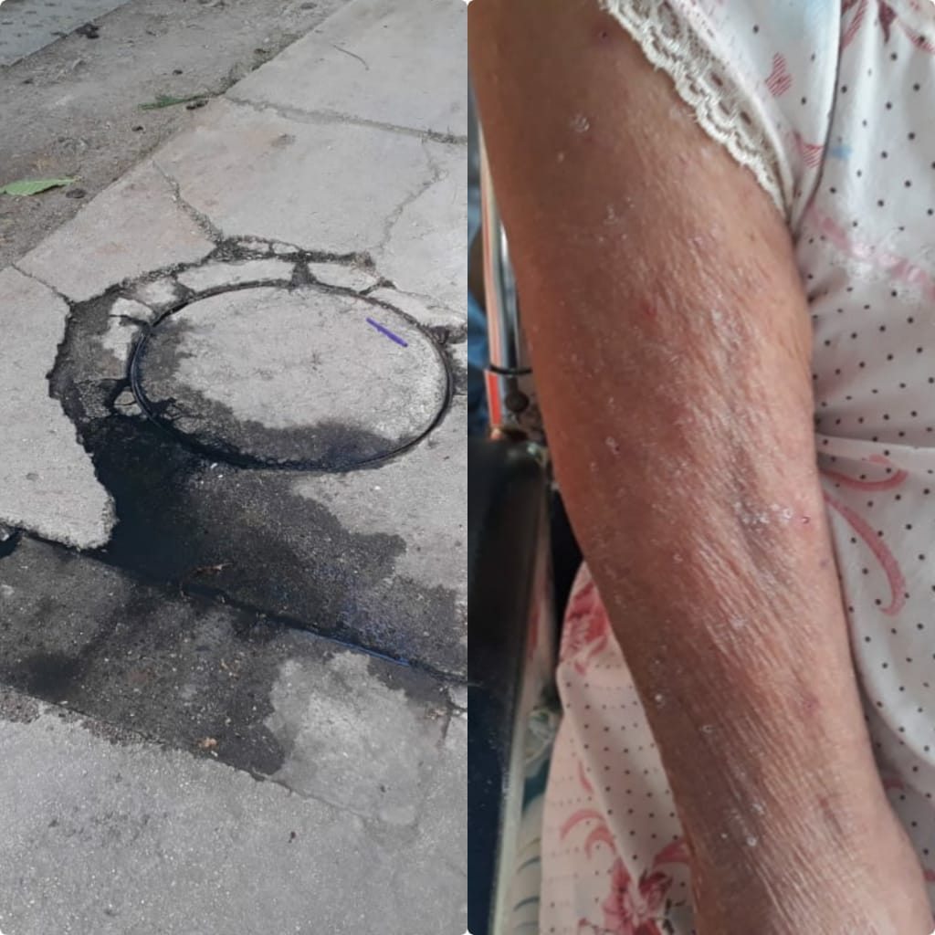 Fuga de agua y malos olores en el Topacio