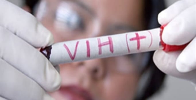 En lo corrido del 2020 se han reportados 81 casos de Sida en el Tolima