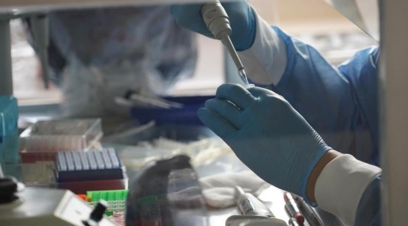 5 nuevos casos de contagio de covid-19 en el departamento del Huila