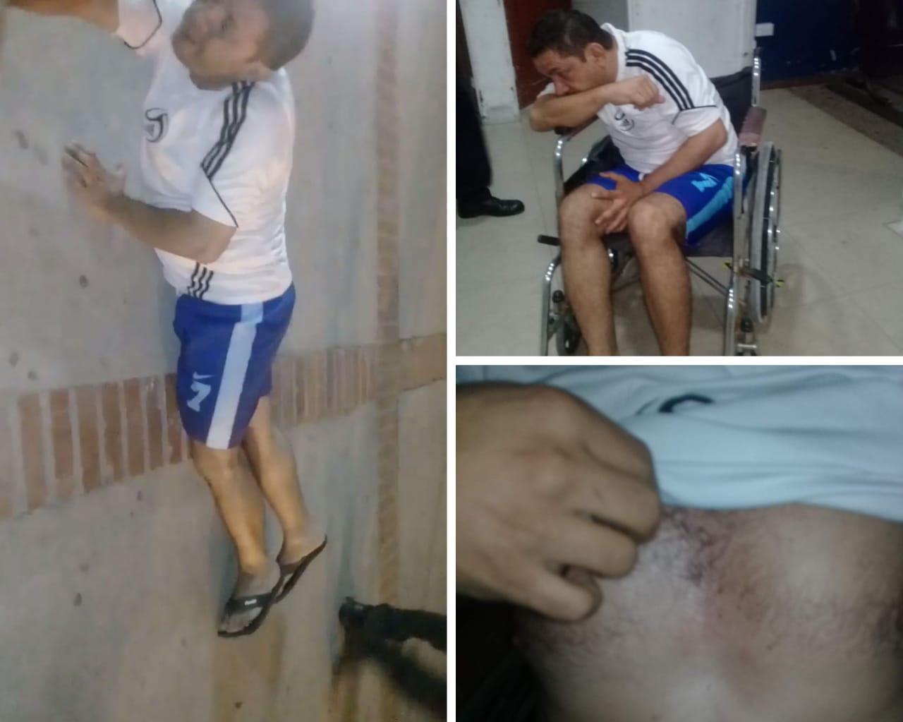 Caso de exceso de fuerza por parte de la METIB