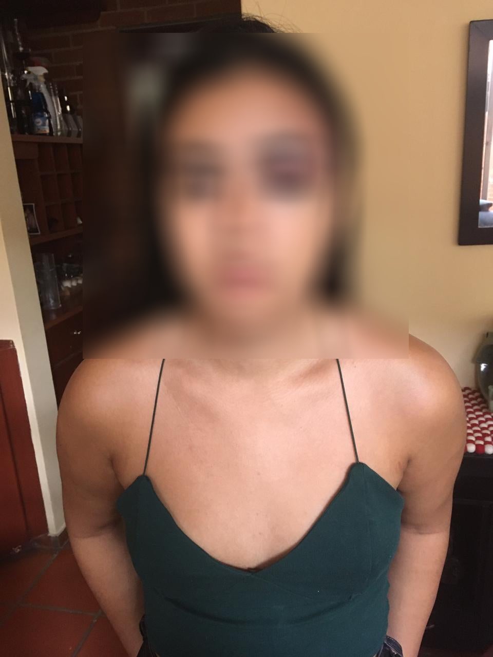 Maltrato a mujer en Ibagué