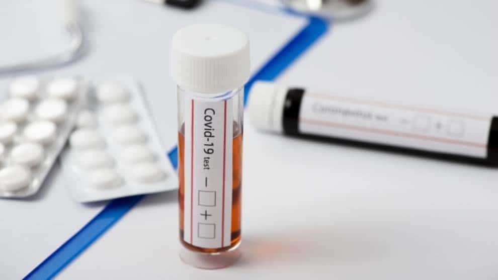 Huila cierra la semana con 227 casos más por Covid-19