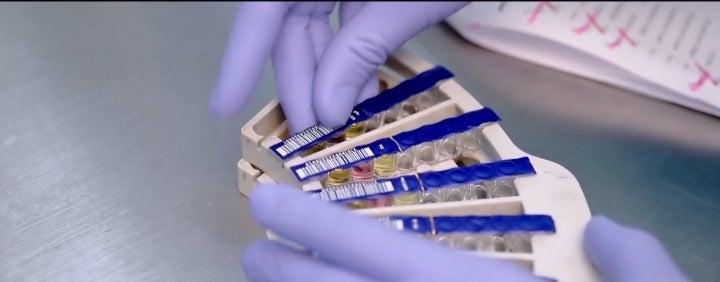 Procesamiento de muestras de COVID-19.