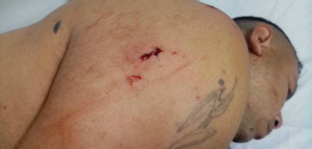 Taxista herido totumo