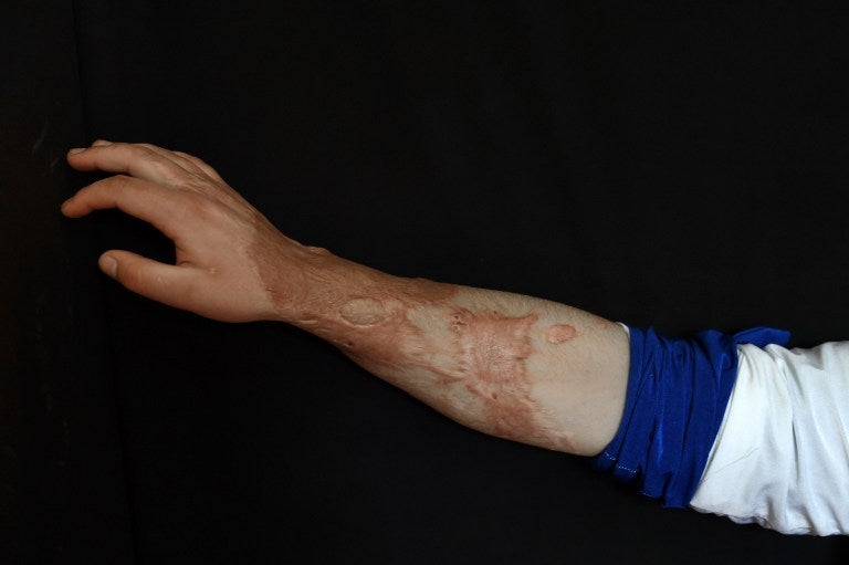 En este ataque la mujer quedó ciega y causó graves daños en el rostro a su hija menor de edad.