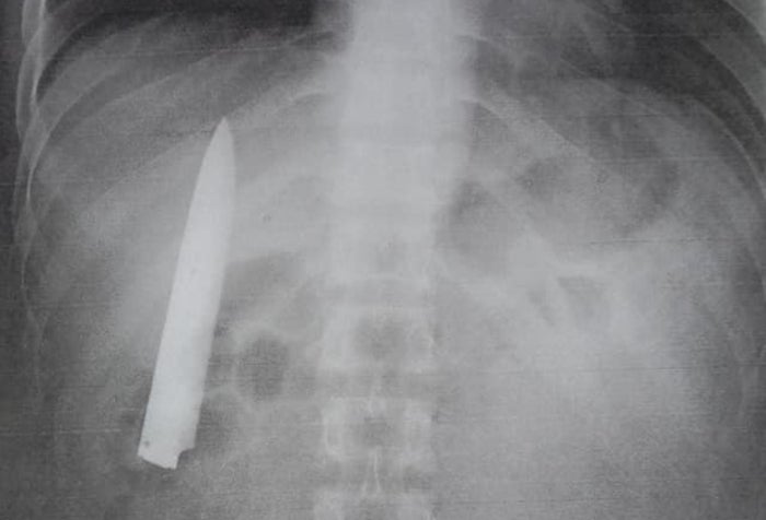 Hoja de cuchillo en un cuerpo
