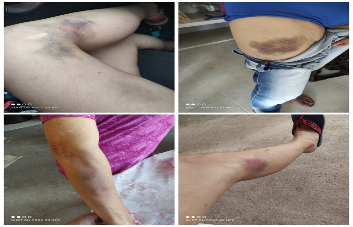 Maltrato a la mujer en Prado - Tolima