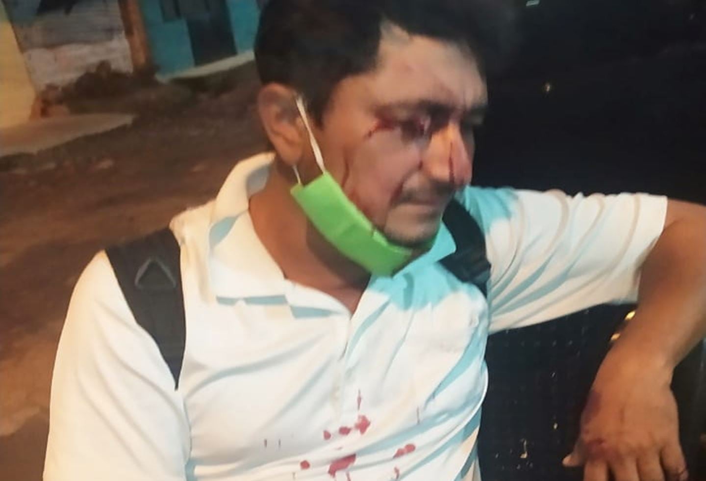 Adolescente lo hirió en el rostro al oponerse a un atraco en Las Américas de Ibagué