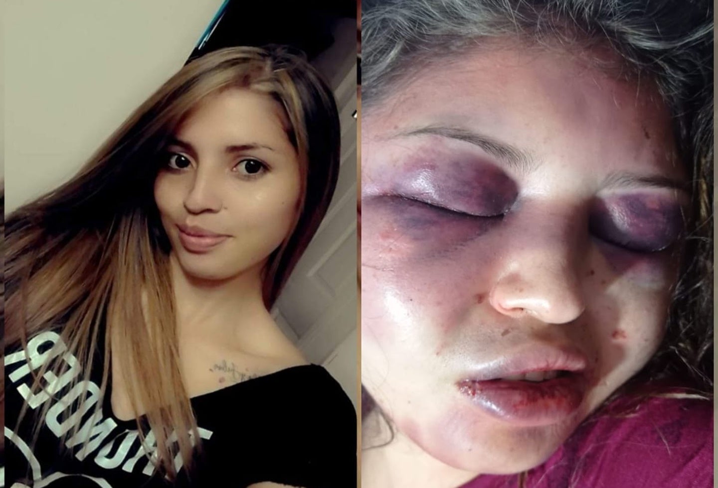 ¡Repudio! Mujer recibió brutal agresión por parte de su expareja en San Luis – Tolima