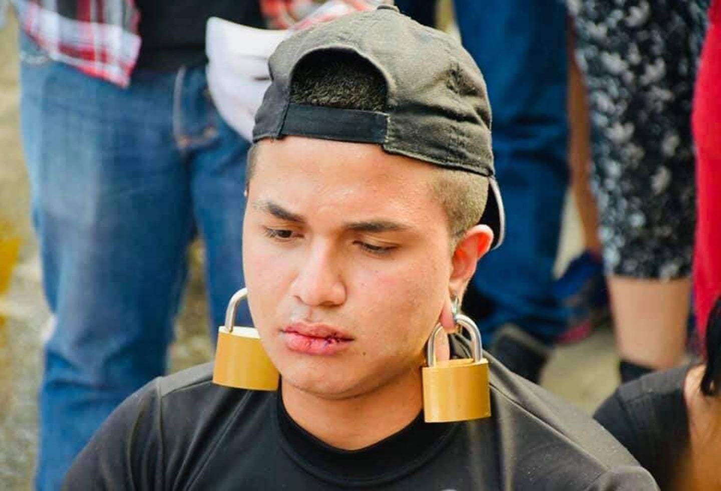 En el marco de la protesta un joven decidió coserse los labios en Ibagué