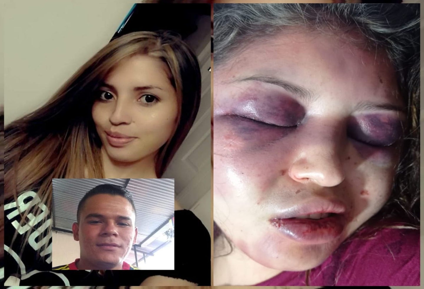 Se conocieron más detalles de la brutal agresión que recibió María Victoria en San Luis – Tolima