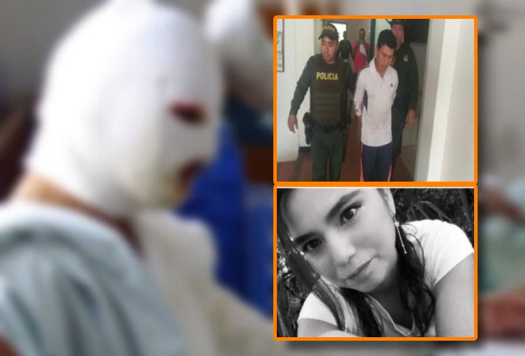 Piden condenar a hombre que le prendió fuego a su expareja