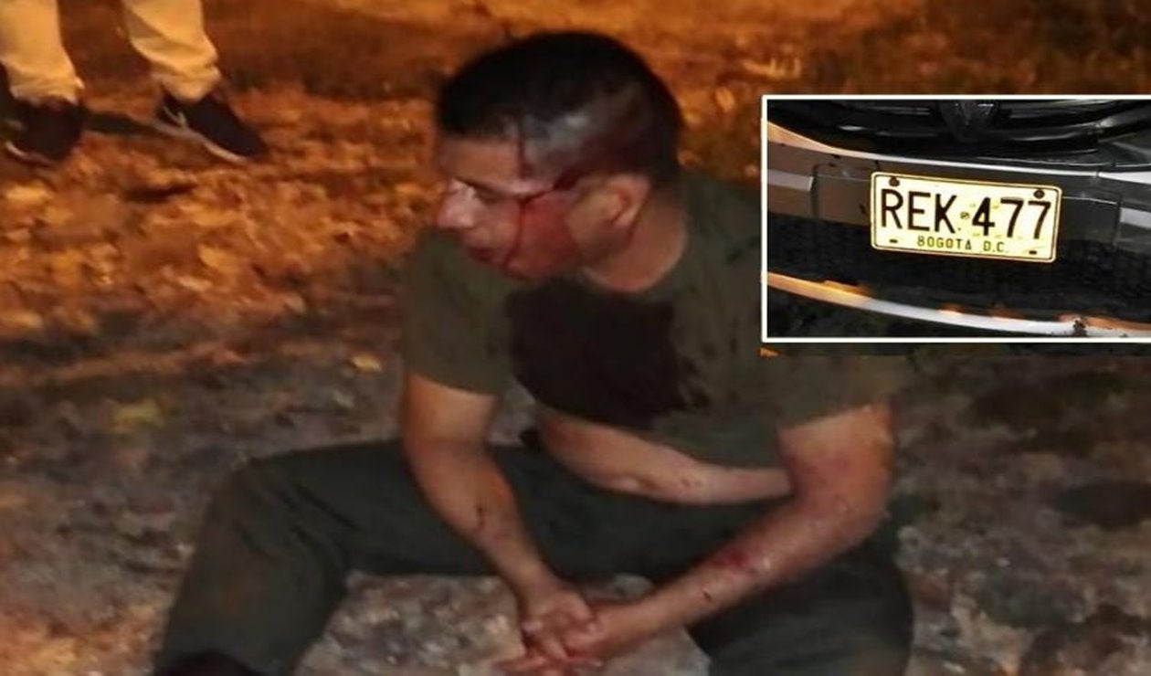 Policía anuncia ‘mano dura’ contra el uniformado borracho que protagonizó accidente en Ibagué