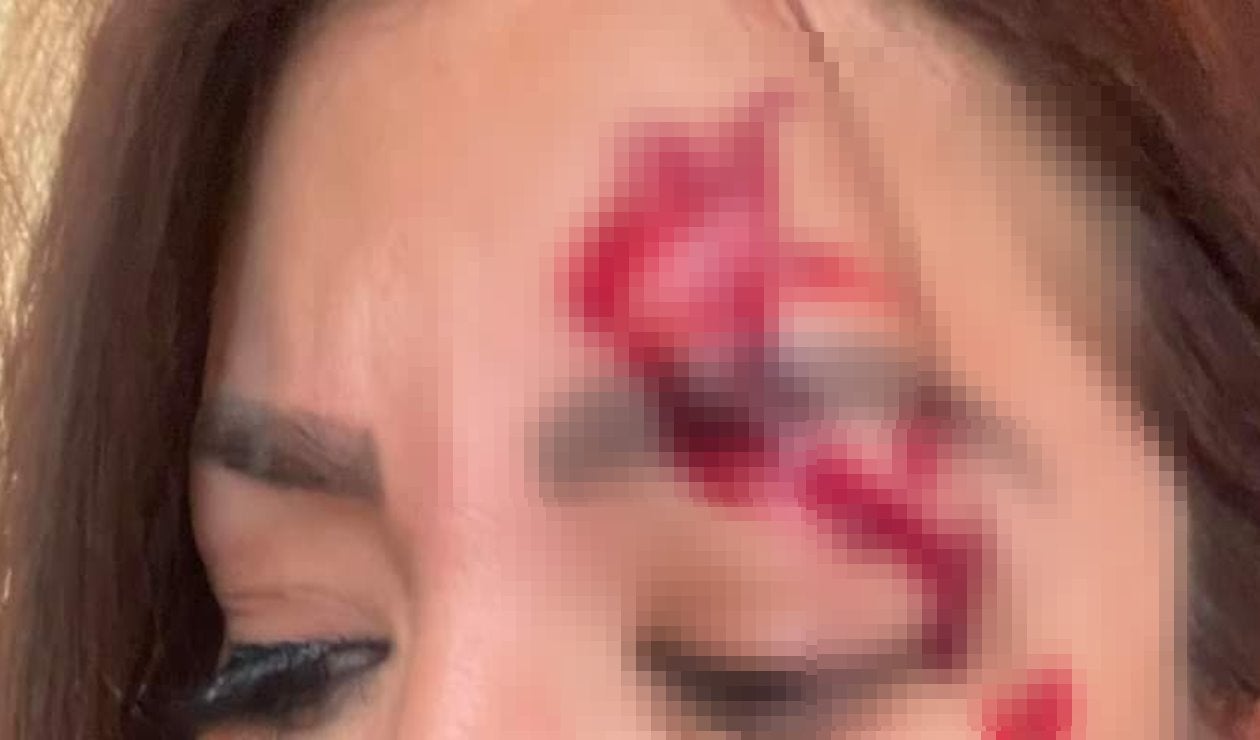 ¡Gavilleros! Entre cuatro motociclistas la golpearon y robaron sobre la Ambalá