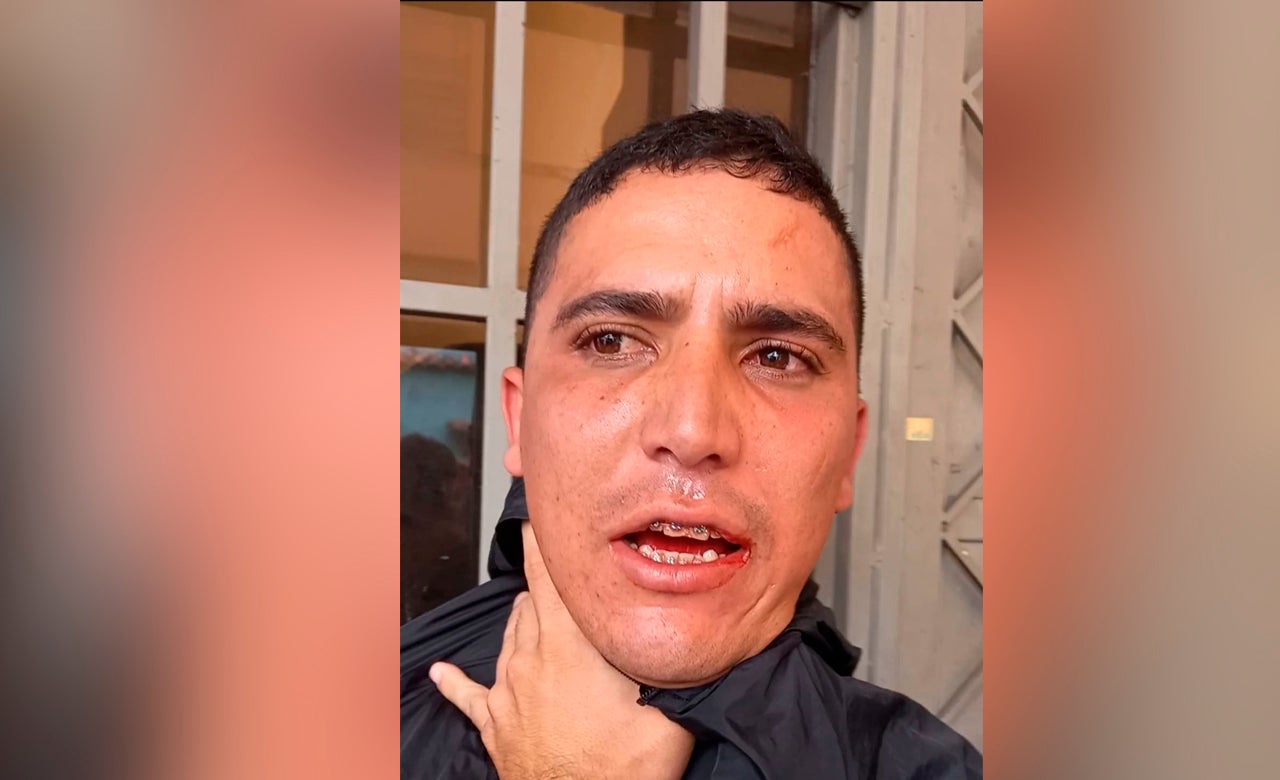 Ladron capturado por comunidad Ibagué