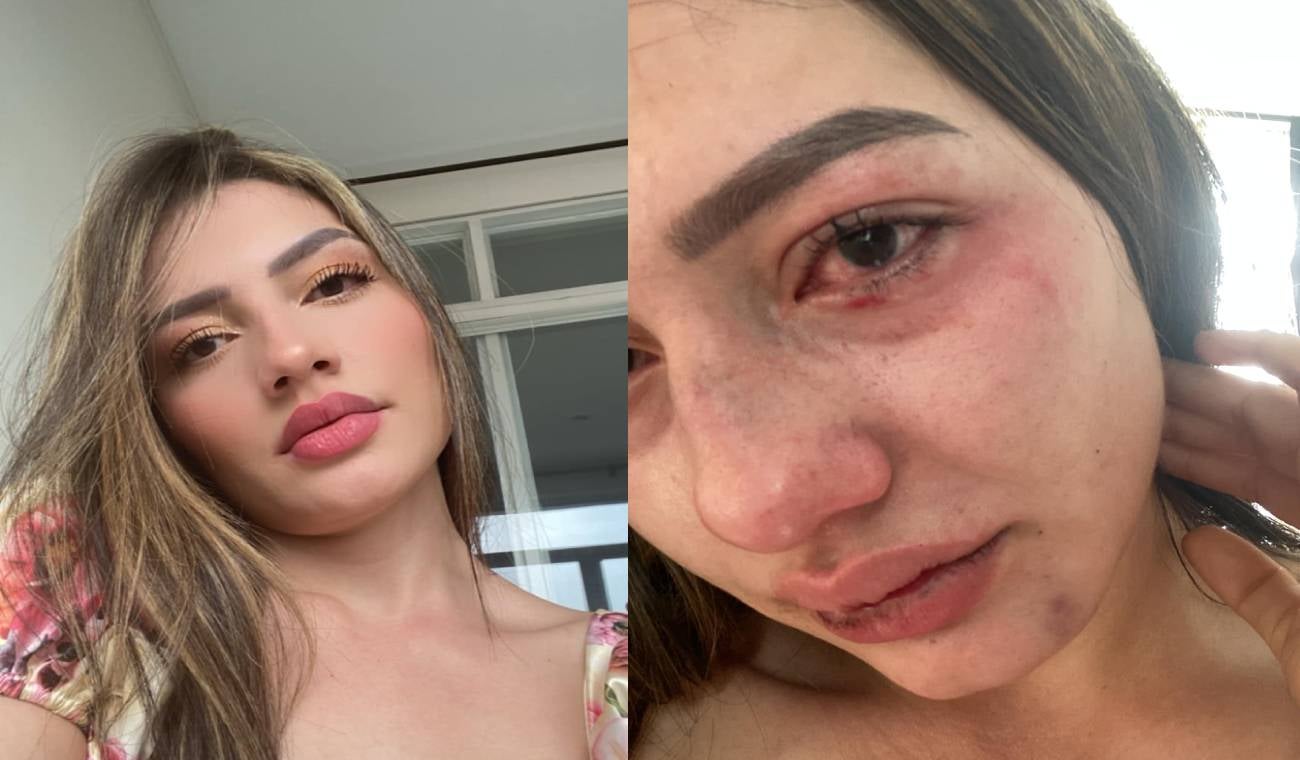 Mujer agredida en un acto de celos e intolerancia