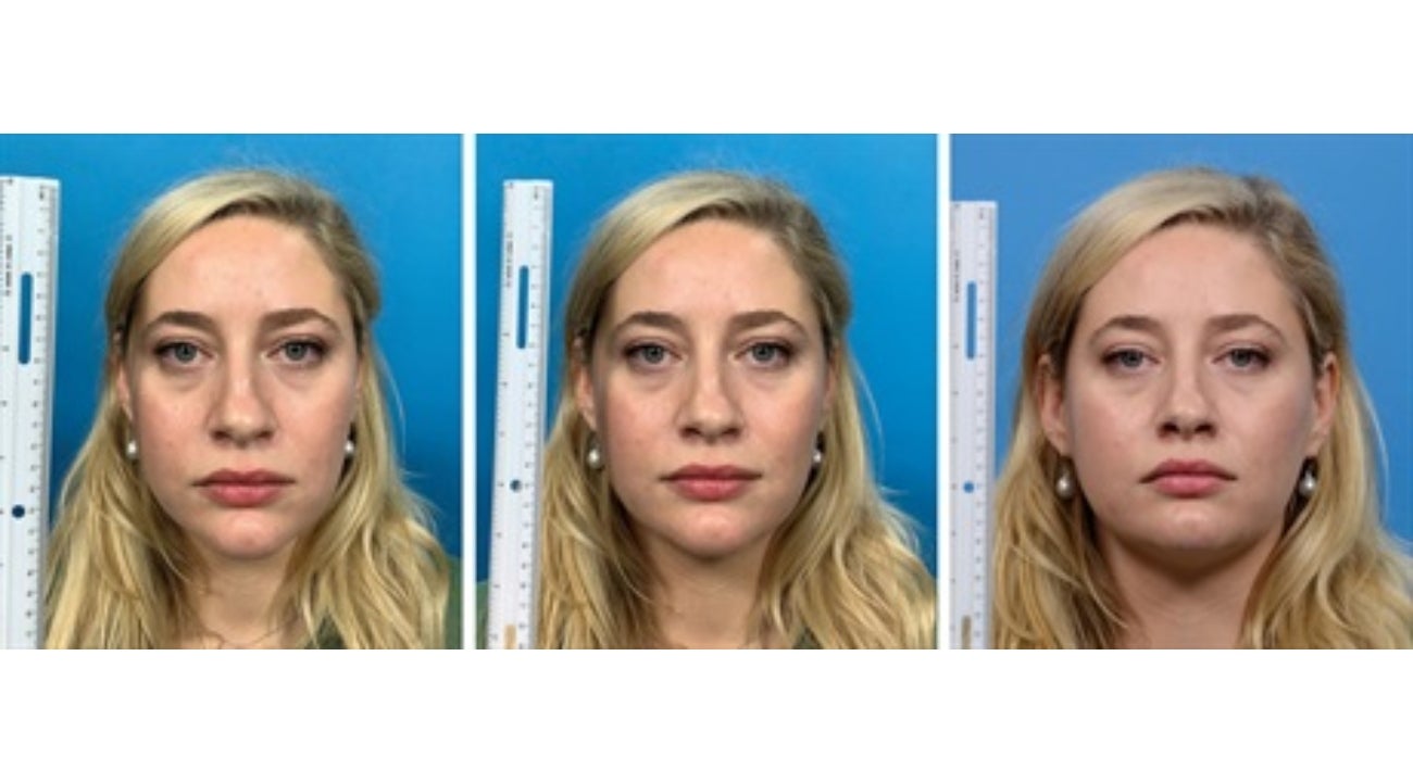 Como afectan las selfies la percepción del rostro