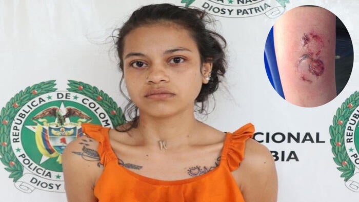 Patrullera fue atacada a mordiscos