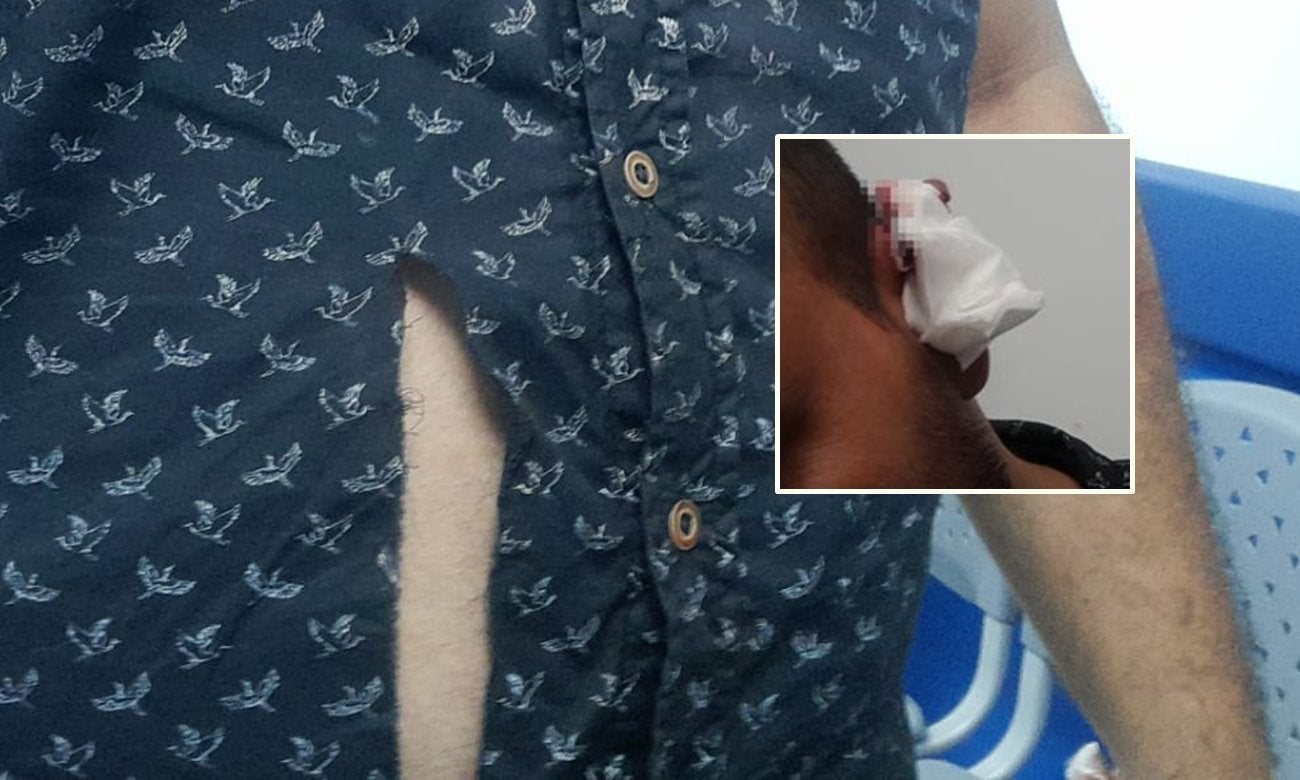 Periodista ibaguereño casi pierde su oreja por negarse a seguir dando dinero a una habitante de calle