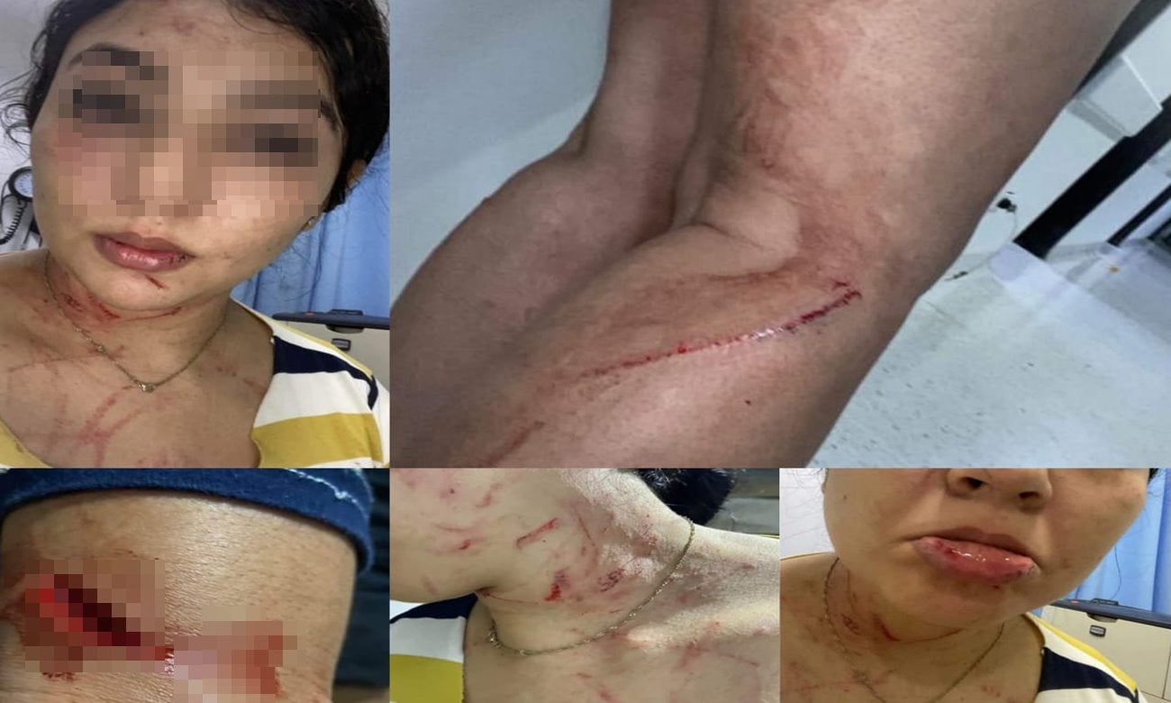 “Mi expareja y su familia me cogieron a machete, puñal y golpes en Picaleña”: Michel Medina