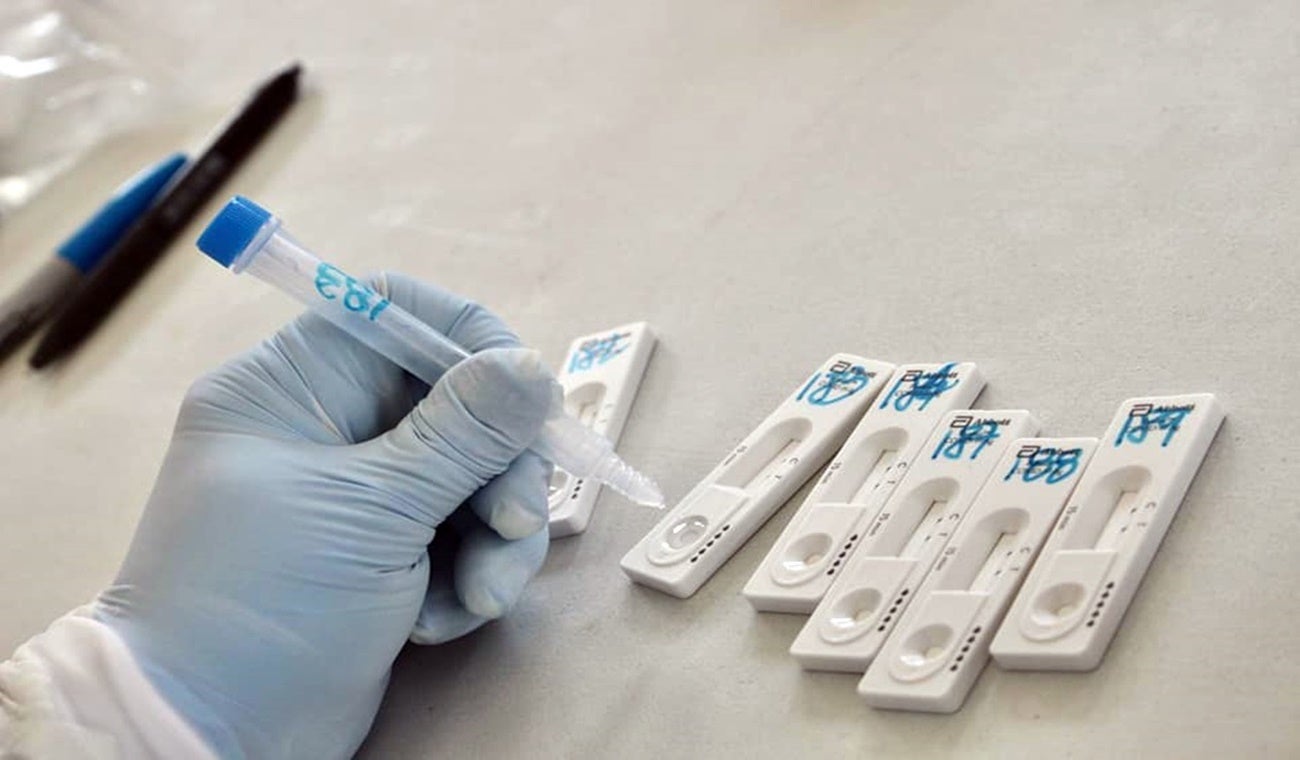 Muestras de Covid-19