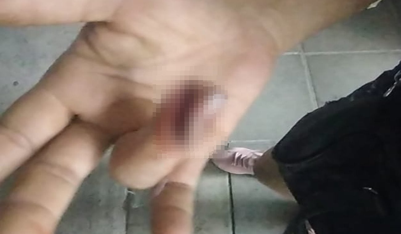 Batalla campal entre dos familias en el barrio Nuevo Combeima