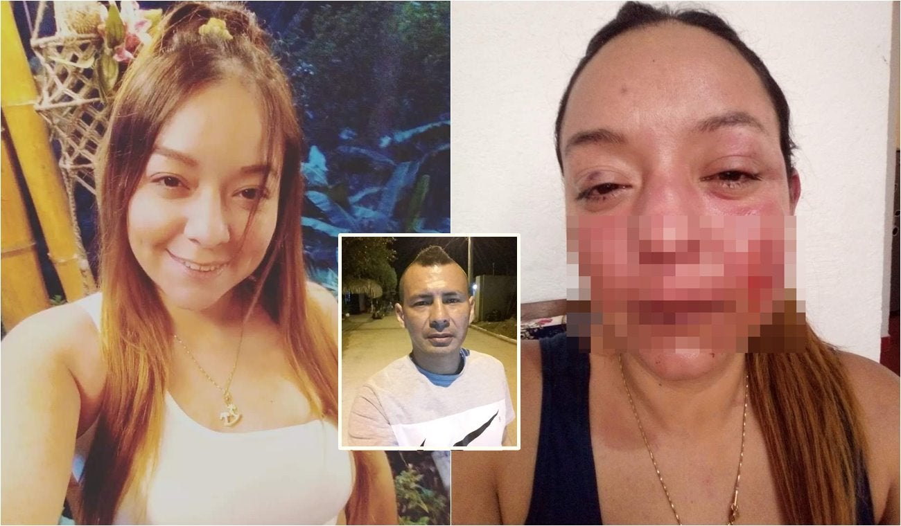 ¡Lo que faltaba! Sujeto podría quedar libre después de agredir salvajemente a mujer ibaguereña