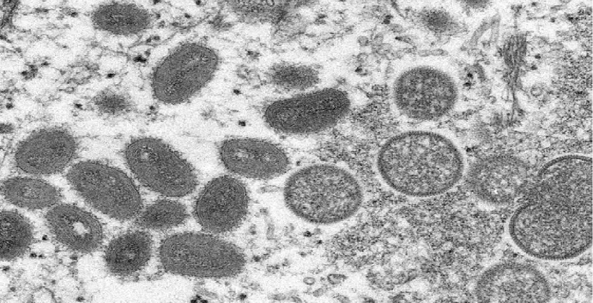 Bogotá, Antioquia, Cali y Cundinamarca las regiones con el mayor número de casos