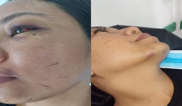 Denuncia maltrato a una mujer en Chaparral