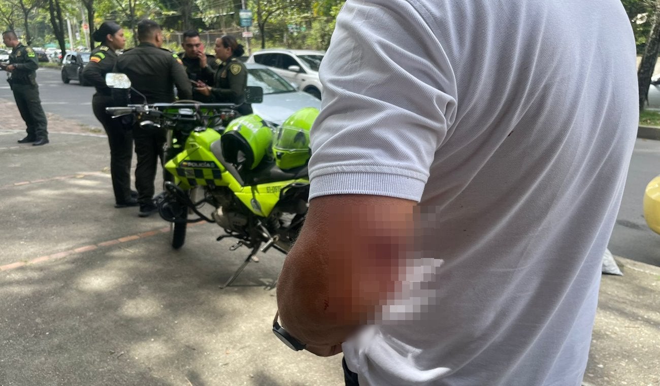 ¡Qué tal esto! Excandidato al Concejo, Javier Amaya, le disparó con arma traumática a un taxista