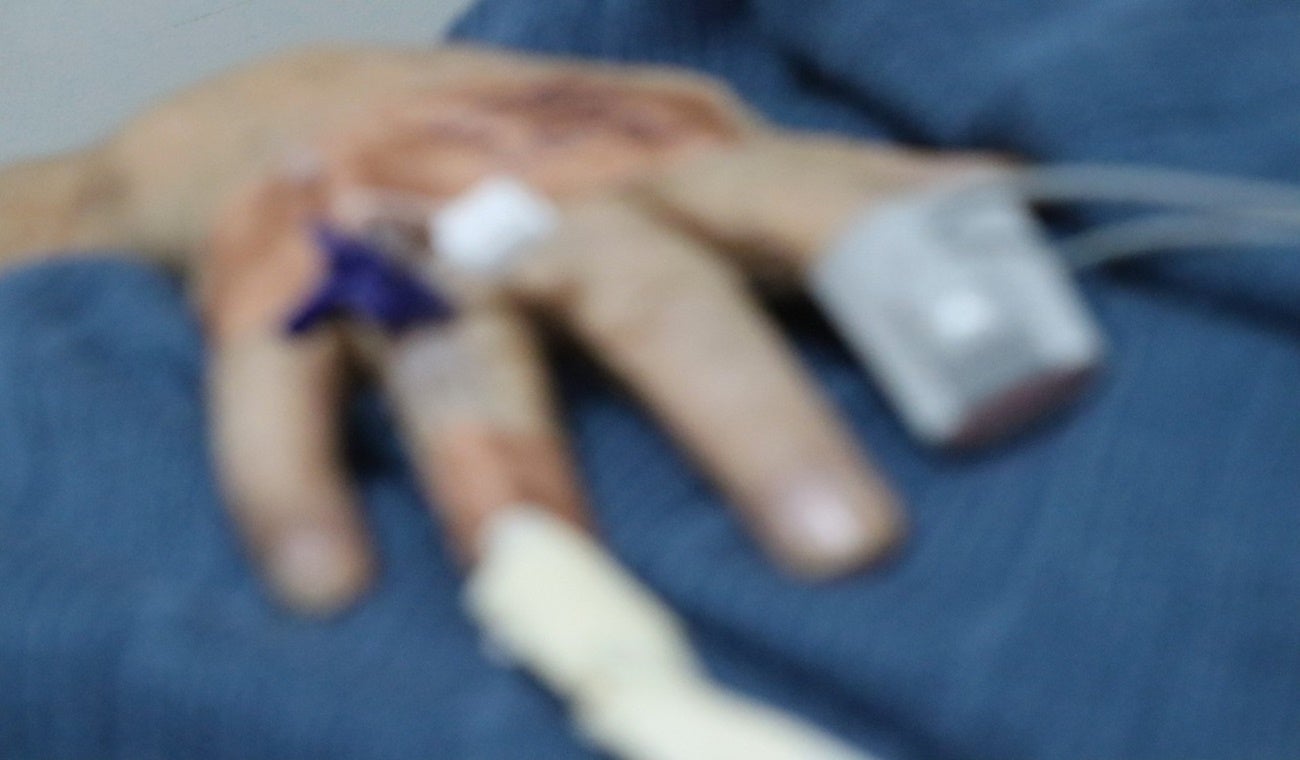 Quemado por polvora Tolima