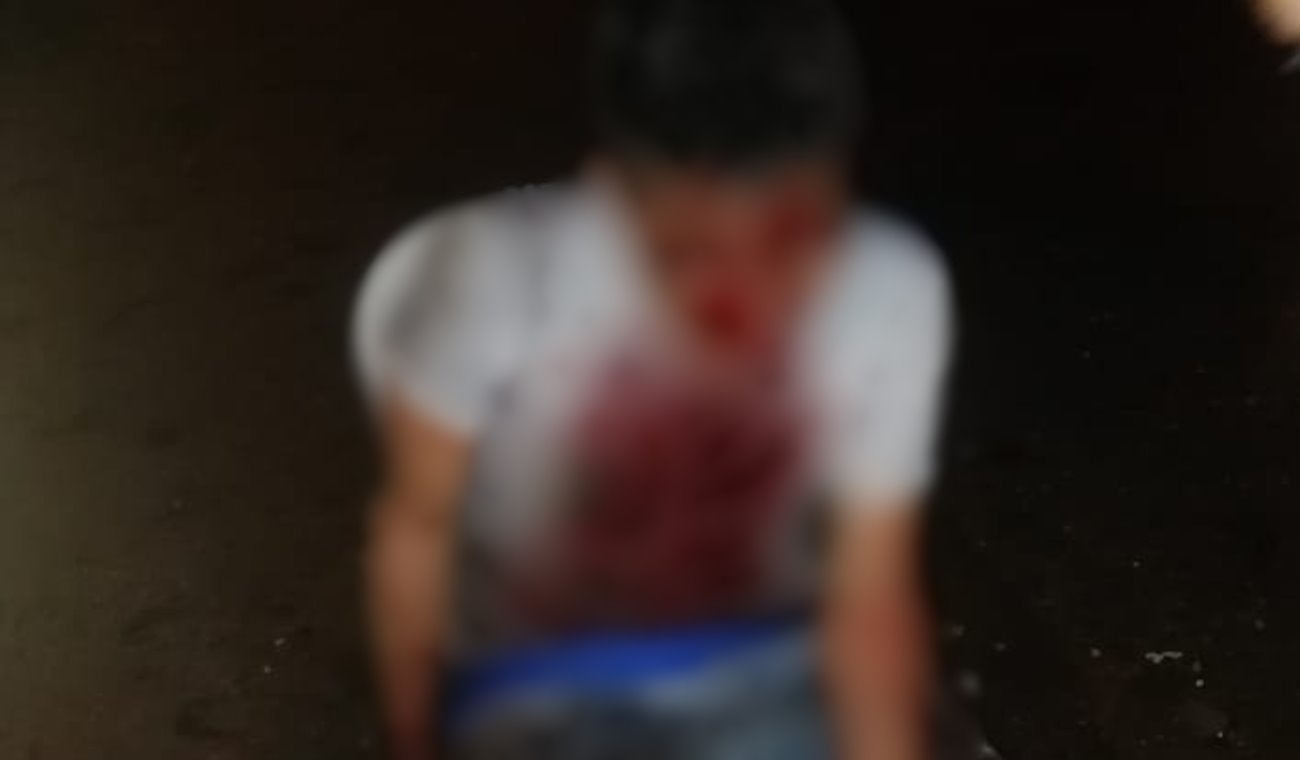 Sujeto invitó a un vecino a tomarse unos tragos y lo cogió a machete en el barrio Nueva Castilla de Ibagué